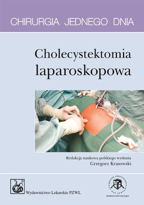 

Chirurgia jednego dnia Cholecystektomia laparoskop