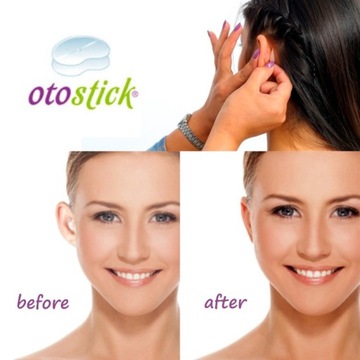 Otostick Korektory ODSTAJĄCE USZY / MASKOWANIE